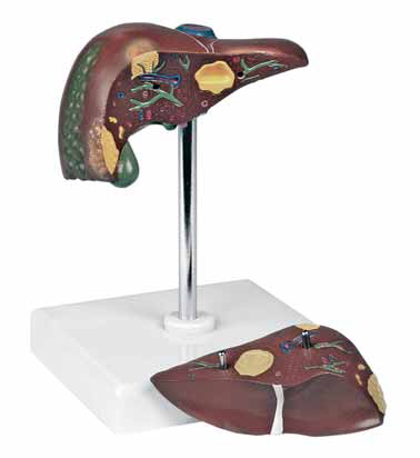 Pathological Model of the Liver